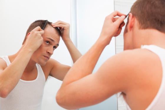 11 dicas para assumir a calvície com muito estilo