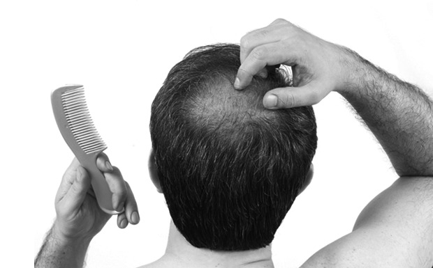 4 cortes de cabelo pra quem está ficando careca